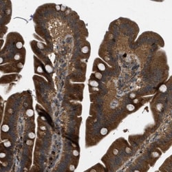 LKAP Antibody, Novus Biologicals:Antibodies:Primary Antibodies